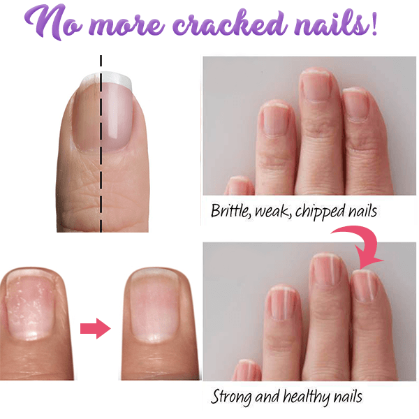 5 In 1 Perfect Nail Kit
